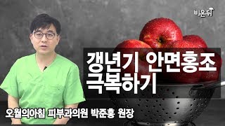 나도 모르게 얼굴이 붉어지는 사람을 위한 박준홍 원장이 알려주는 치료법