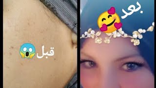 اوا البنات الغزالات اجيو نتهلاو في حالتناث😍🥰/وصفة إزالة الزفر من الدجاج/سد مسام البشرة😱😍