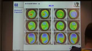 AIOC2022 GP126 topic DR  PRIYANKA SATHE Epithelial mapping