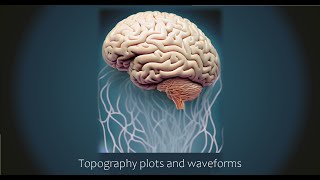 EEGLAB Visualisation Series: Creating topography plots \u0026 waveforms