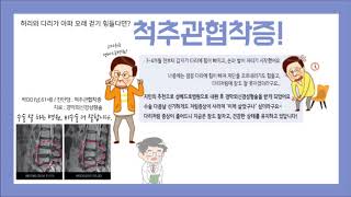 [성베드로병원] 척추관협착증