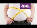 صباح العربية | إنقاص الوزن يعتمد فقط على السعرات