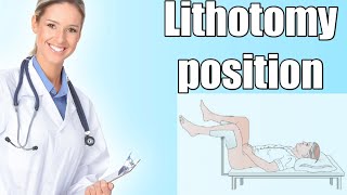 Lithotomy position| indications | Physiological effects | Hazards