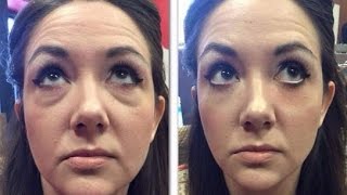 Cremas con efecto botox instantáneo bolsas de ojos arrugas en la cara labios