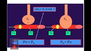 PA Catheter | | Dr. Pradeep Rangappa