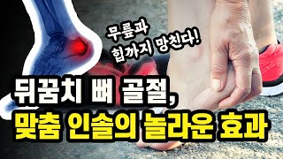 뒤꿈치뼈 골절_맞춤인솔의 놀라운 효과_운동법_연구실험