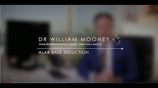 Dr William Mooney: Alar Base Reduction