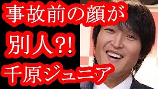 【驚愕】千原ジュニア　事故前の顔と全然違う！