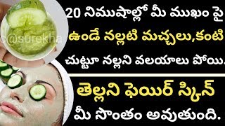 20 నిముషాల్లో మీ ముఖం పై ఉండే నల్లని మచ్చలు పోయి ముఖం తెల్లగా  . (skin whitening remedy Telugu)