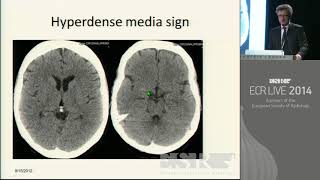 Neuro Basic 2   Basic Session on Neuroradiology 2