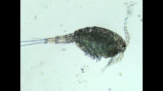 A Cyclopoida found in a water sample from a local park