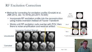 Fundamentals and History of Zero Echo Time (ZTE)  MRI