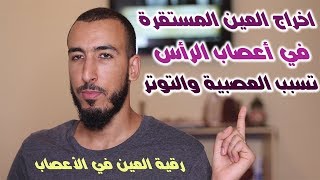 إخراج العين الساكنة في أعصاب الرأس تسبب العصبية والتوتر والإنفعال