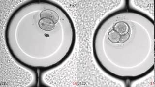 Prediction model for aneuploidy in early human embryo development revealed by single-cell analysis