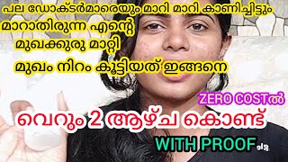 😮മാറാതെ ഇരുന്ന മുഖക്കുരു 2ആഴ്ച കൊണ്ട് മാറ്റി മുഖം നിറം കൂട്ടിയത് ഇങ്ങനെ🤓|Pimple removal mask