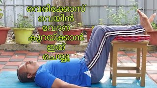 വെരിക്കോസ് വെയിൻ വേദന കുറയ്ക്കാം||The Pain of Vericose vain can be reduced || Relax n YogaWithLaL