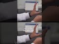 shortsvideo shortvideo shortfeed كيف يعرف الرجل إن كان يحمل أمراض منقولة جنسيا ؟