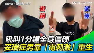 吼叫1分鐘僵硬！妥瑞症男天天發作20次靠「電刺激」重生｜三立新聞網 SETN.com