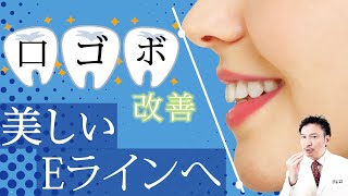 【コンプレックス解消】口ゴボを改善して美しいEラインへ【歯列矯正】