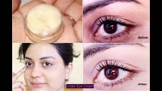 EYE CREAM To Remove Intense Dark Circles, Fine lines, Puffiness, Wrinkles & Spots Naturally & Fast