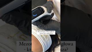 Mezoterapia Mikroigłowa - którą wybrać?