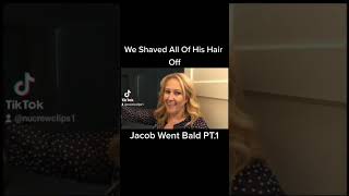 Jacob Goes Bald 👨‍🦲