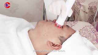 Facelift Treatment by myChway Ultrasonic Cavitation RF Machine