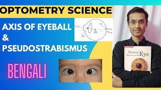 Axis of Eyeball | Pseudostrabismus (Bengali) | Optometry science