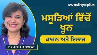 ਖੂਨ ਵਹਿਣ ਵਾਲੇ ਮਸੂੜਿਆਂ ਦਾ ਇਲਾਜ ਕੀ  ਹੈ? | Care of Bleeding Gums/ Gingivitis, Punjabi | Dr Anjali Sofat