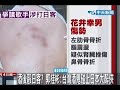 酒後毆日客？郭桂彬：台灣酒鬼碰上日本大醉俠