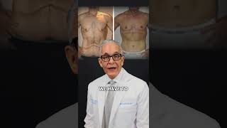 How to lose the excess skin after a major weight loss? Plastic Surgeon Explains!