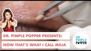 Now That's What I Call Milia!