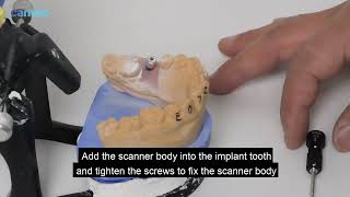 4 CAMEO elegant Ⅲ implanting scanning guidance video