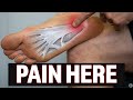 Plantar Fasciitis (Education | Myths | Stretching & Strengthening Exercises)