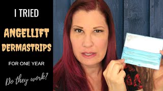 DO ANGELLIFT DERMASTRIPS REALLY WORK? // Angel Lift Before and After 1 Year Results!