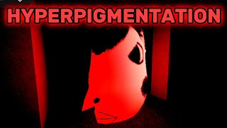 ROBLOX ESCAPE HYPERPIGMENTATION!