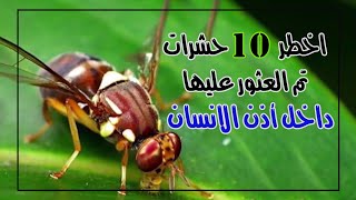 اخطر 10 حشرات تم العثور عليها داخل _ أذن الانسان _ قد تسبب الوفاه للشخص ..!