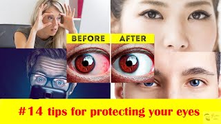 How to Protect Your Eyes in 14 Ways