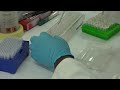 Zimbabwe hit by Malaria outbreak amid Covid-19 lockdown