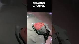 【鼻整形】術後から1週間までの経過お見せします★#shorts