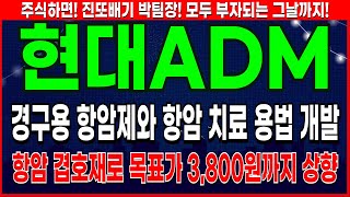 현대ADM - 경구용 항암제 흡수율 1600배 현대ADM 주가 전망 및 대응