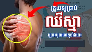 Cause of shoulder pain - គ្រូពេទ្យប្រាប់មូលហេតុនាំឱ្យឈឺស្មា - Page Of Life