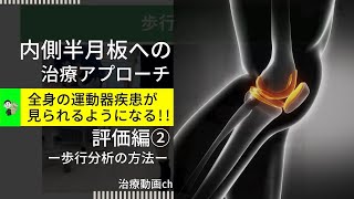 膝③｜内側半月板損傷３歩行分析の方法を教えます！