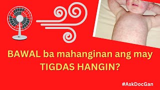 Pwede ba mahanginan ang may TIGDAS HANGIN? | AskDocGan