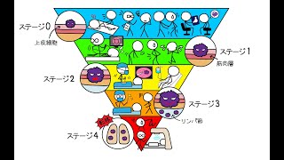 【全解説】ガンの進行レベルを16分で解説