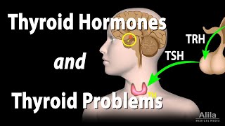 Cure Thyroid Problem Permanently in 4 Steps