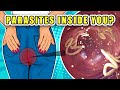 Don't Ignore These Early Symptoms of Parasites In Your Body