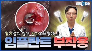 공든 탑도 무너질 수 있습니다! 제발.. 조금이라도 이상하면 일단 치과부터 찾으세요..