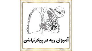 آمبولی ریه