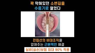 막혔던 소변길을 시원하게 열어줍니다